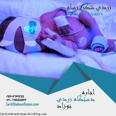 اجاره دستگاه زردی نوزاد و درمان قطعی زردی با دستگاه فتوتراپی رسام